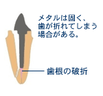 ファイバーコア